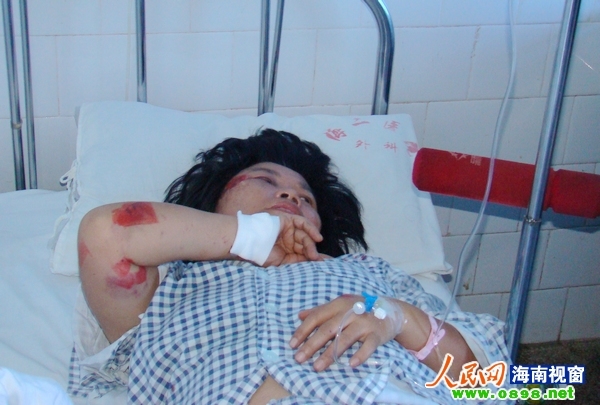 五指山特大交通事故傷員