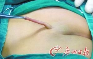 女?huà)肫ü缮祥L(zhǎng)尾巴