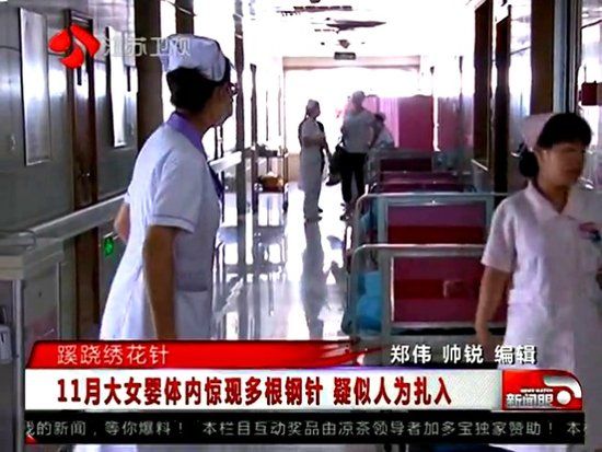 女嬰體內(nèi)4根繡花針