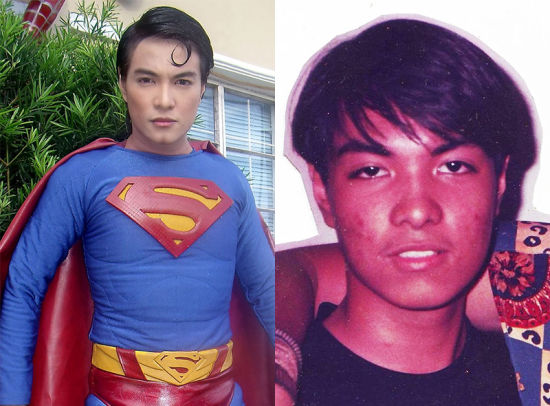 菲律賓男子整容13次成超人