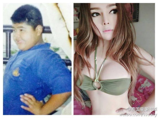 泰國小胖墩變性成辣妹
