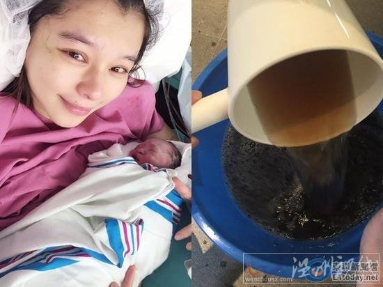 徐若瑄坐月子臥床162天不洗澡