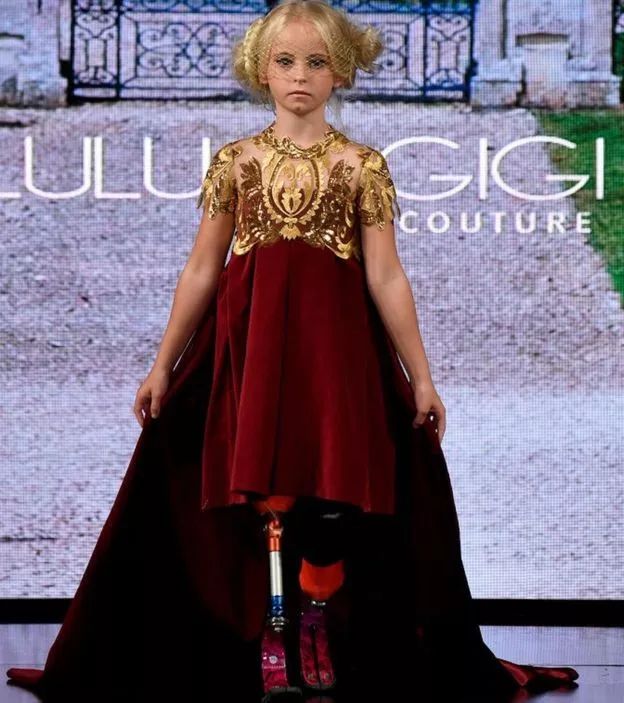 截肢仙女紅遍全球